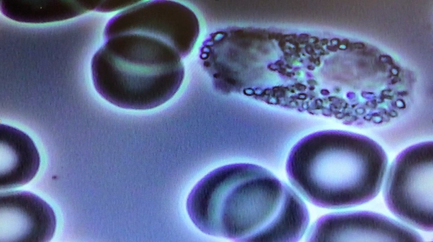 Understanding Blood Chemistry and Immune Patterns Masterclass